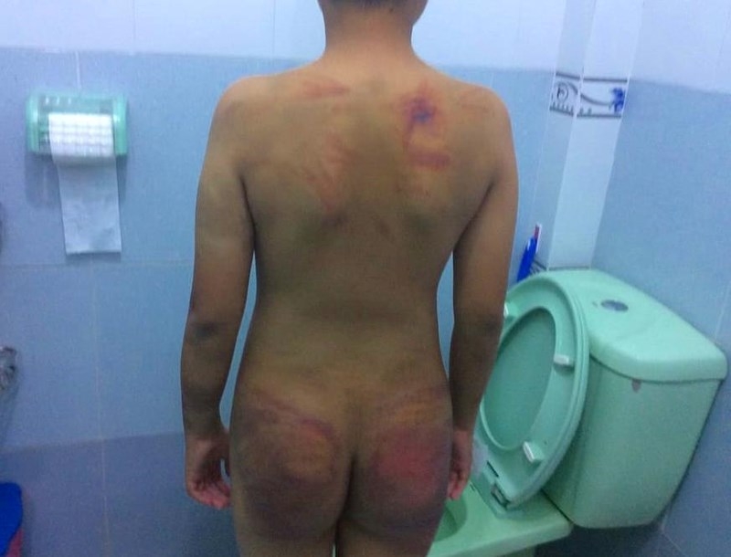 be trai 11 tuoi bi 1 nguoi tu hanh danh da man trong khoa tu he