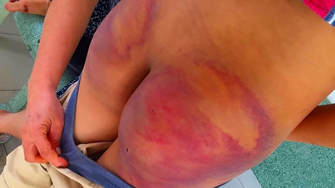 be trai 11 tuoi bi 1 nguoi tu hanh danh da man trong khoa tu he