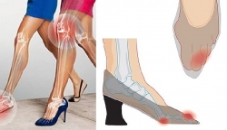 di giay cao got lai xe o to nguy co gay tai nan giao thong lon