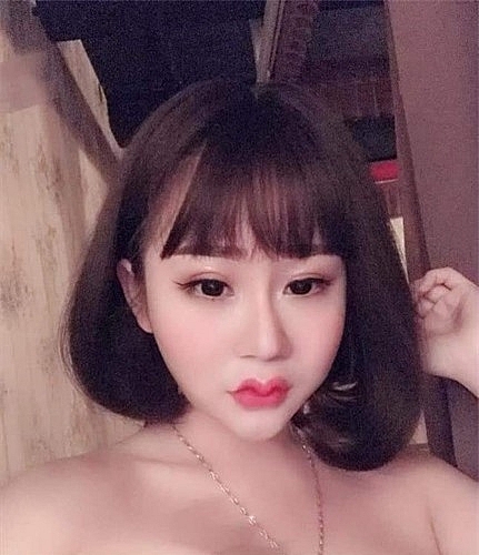 hot trend moi canh en mazda va nhung nguy co ruoc hoa khi phau thuat tham my moi