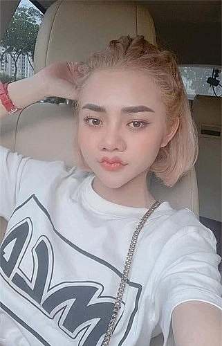 hot trend moi canh en mazda va nhung nguy co ruoc hoa khi phau thuat tham my moi