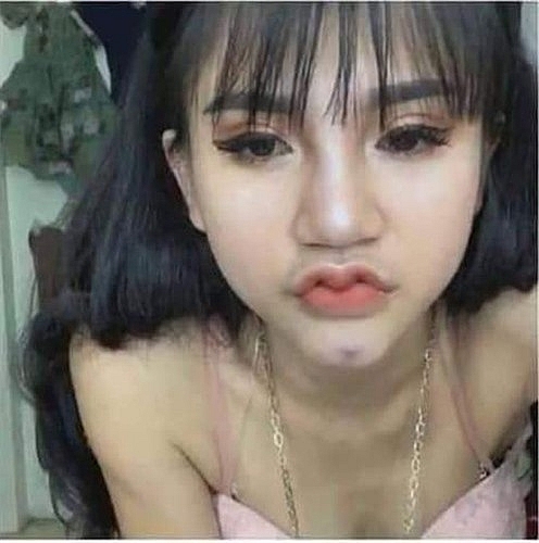 hot trend moi canh en mazda va nhung nguy co ruoc hoa khi phau thuat tham my moi