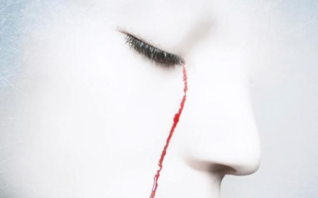 Bị coi là "phù thuỷ" vì mắc hội chứng khóc ra máu