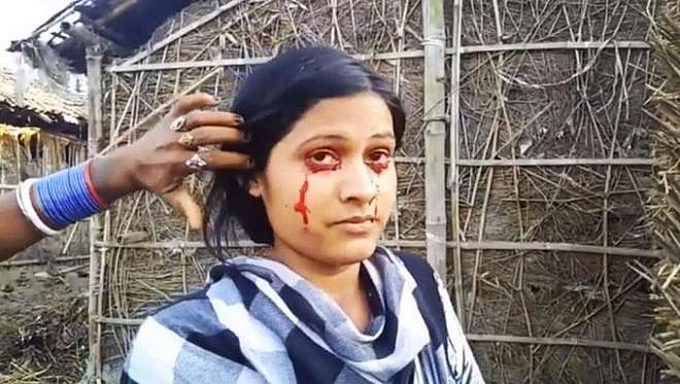 bi coi la phu thuy vi hoi chung khoc ra mau