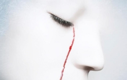 Bị coi là "phù thuỷ" vì mắc hội chứng khóc ra máu