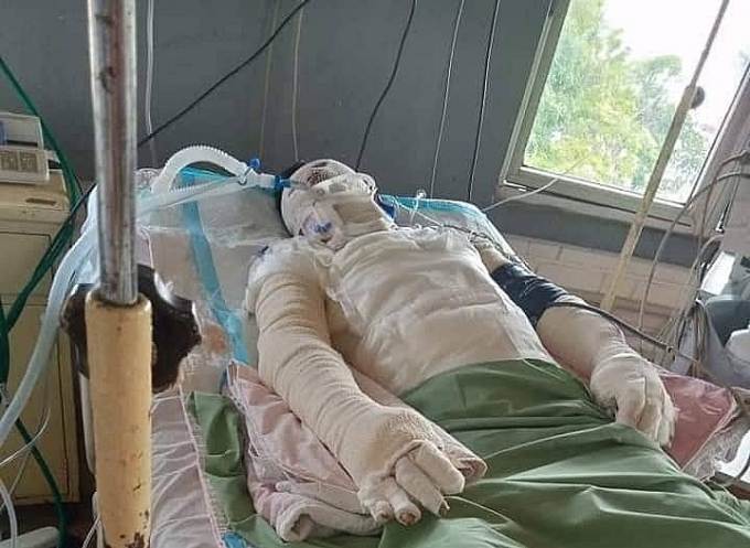 Hai lao động người Nghệ An thương vong vì hỏa hoạn ở Malaysia hai lao dong nguoi nghe an thuong vong vi tai nan lao dong o malaysia