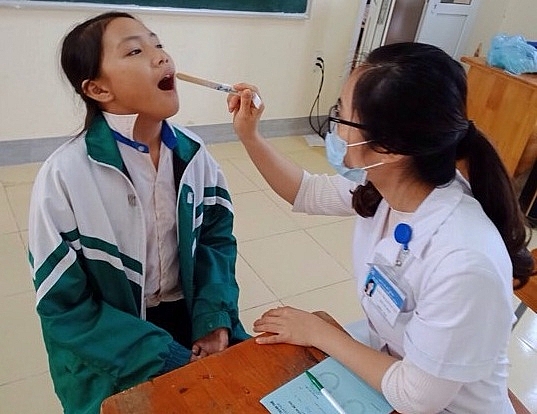 Gần 600 học sinh Hà Tĩnh được khám và chăm sóc răng miệng miễn phí gan 600 hoc sinh ha tinh duoc kham cham soc rang mieng mien phi