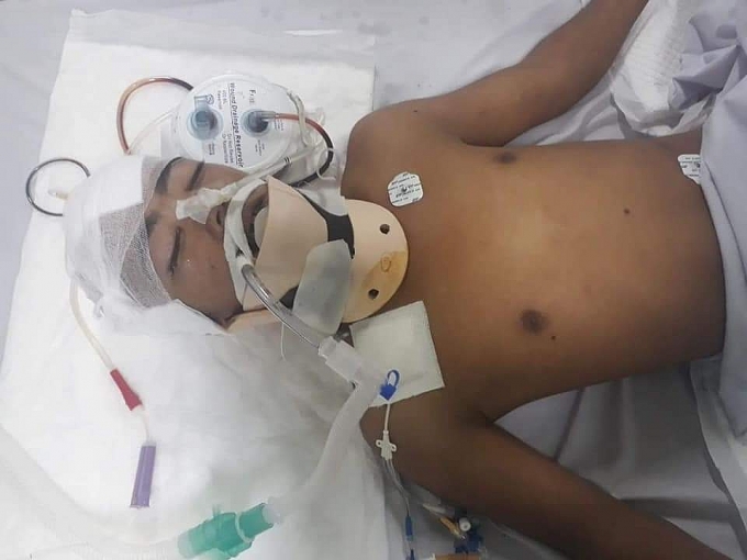 Ngã giàn giáo, chàng thanh niên nghèo 'thập tử nhất sinh' nga gian giao chang thanh nien ngheo thap tu nhat sinh