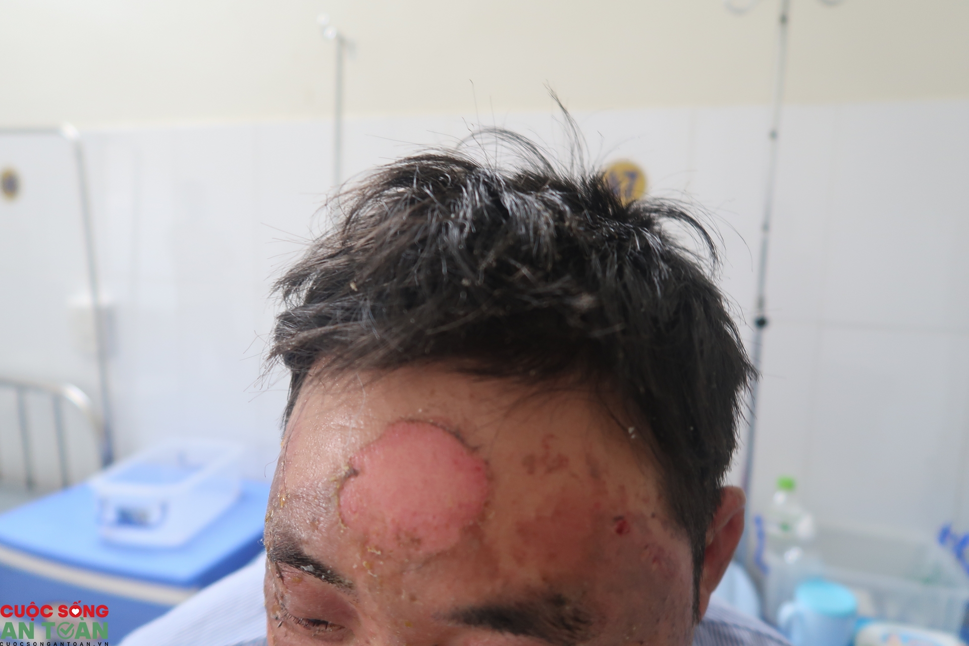 Vụ cháy nhà xưởng ở Vân Trung: Người trong cuộc kể lại sự việc