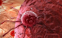 Cơ chế kháng thuốc của tế bào ung thư như thế nào?