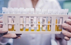 Hiến huyết tương để mang lại cơ hội sống cho những bệnh nhân nhiễm Covid-19