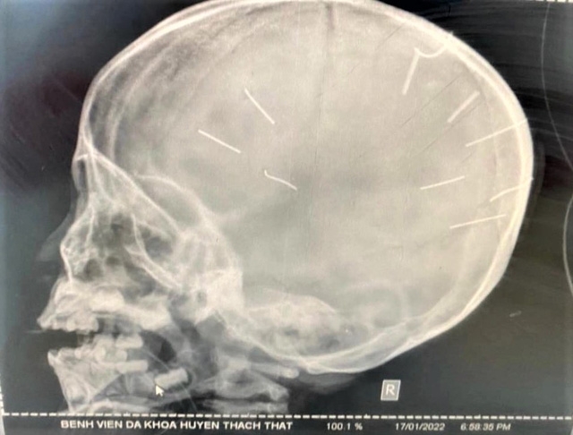 Những chiếc đinh của quỷ Những chiếc đinh của quỷ