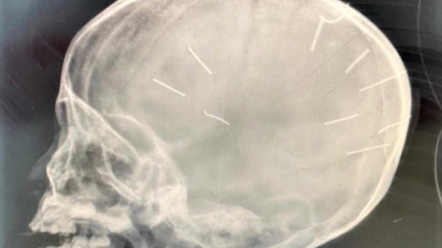 Những chiếc đinh của quỷ