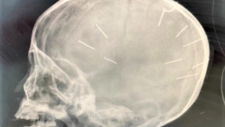 Những chiếc đinh của quỷ